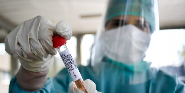 Coronavirus. In Abruzzo 152 nuovi contagi e sei morti. Variante inglese: decine di casi
