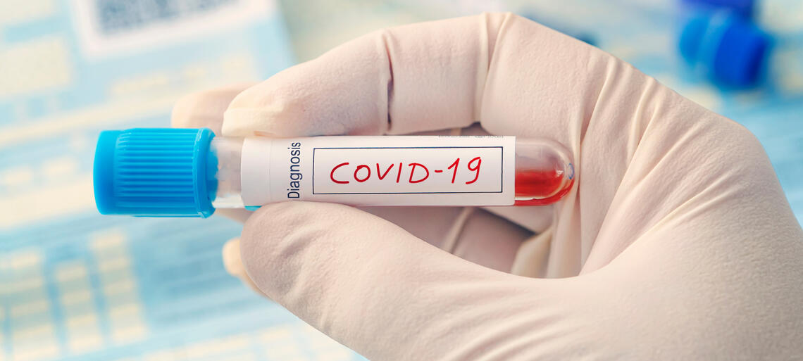 Coronavirus. In Abruzzo 556 nuovi casi e 7 decessi