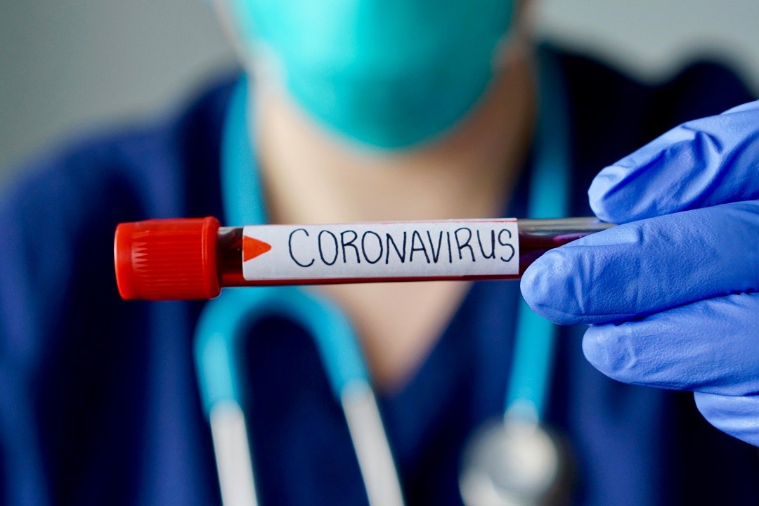 Coronavirus. In Abruzzo 343 contagi e 7 morti