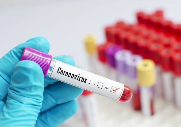 Coronavirus. Secondo caso alla Tiberina Sangro di Atessa. E i dipendenti scioperano
