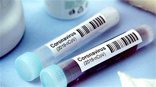 Coronavirus. In Abruzzo 642 nuovi casi e 11 decessi
