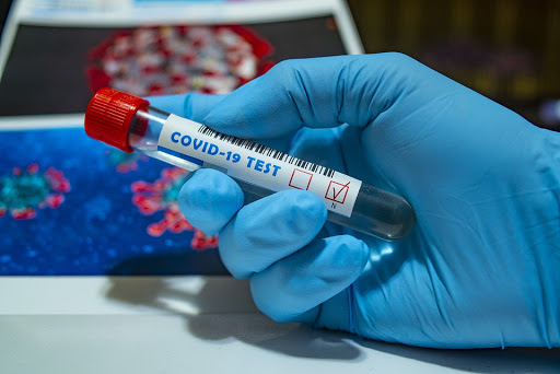 Coronavirus. Dodici nuovi casi a Fossacesia