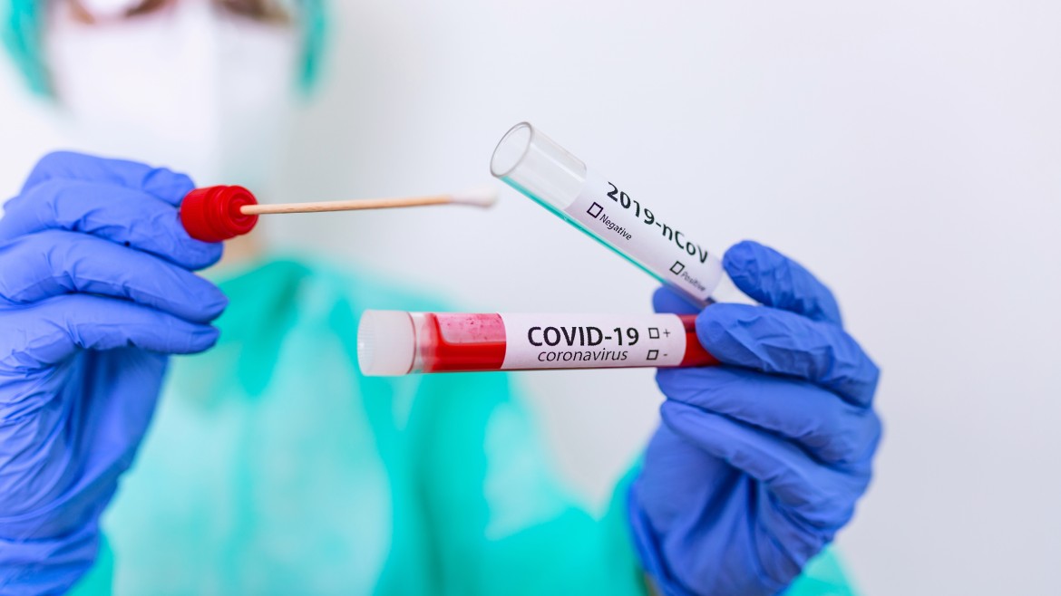 Coronavirus. In Abruzzo 4 nuovi contagiati, di età compresa tra 24 e 59 anni