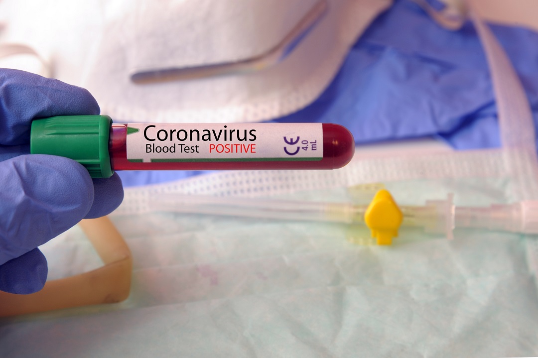 Coronavirus. In Abruzzo diciotto nuovi casi