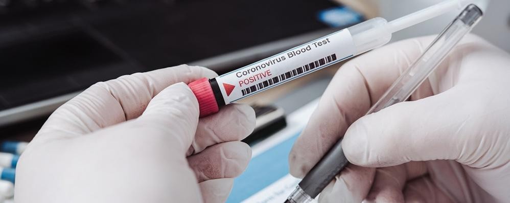 Coronavirus. Nove nuovi casi in Abruzzo. Un altro decesso