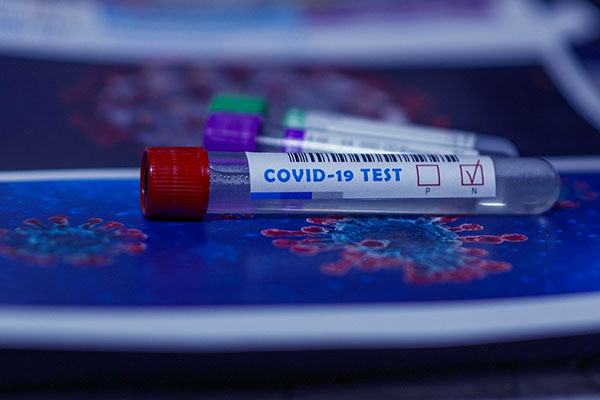 Coronavirus. In Abruzzo 306 nuovi casi e un altro morto