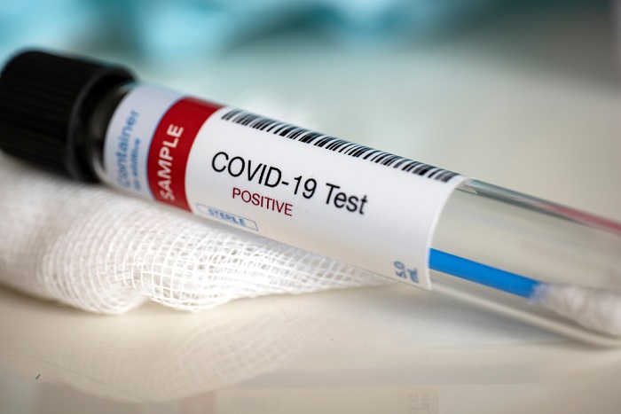 Coronavirus. Trenta nuovi contagiati in Abruzzo, tra cui bimba di un anno