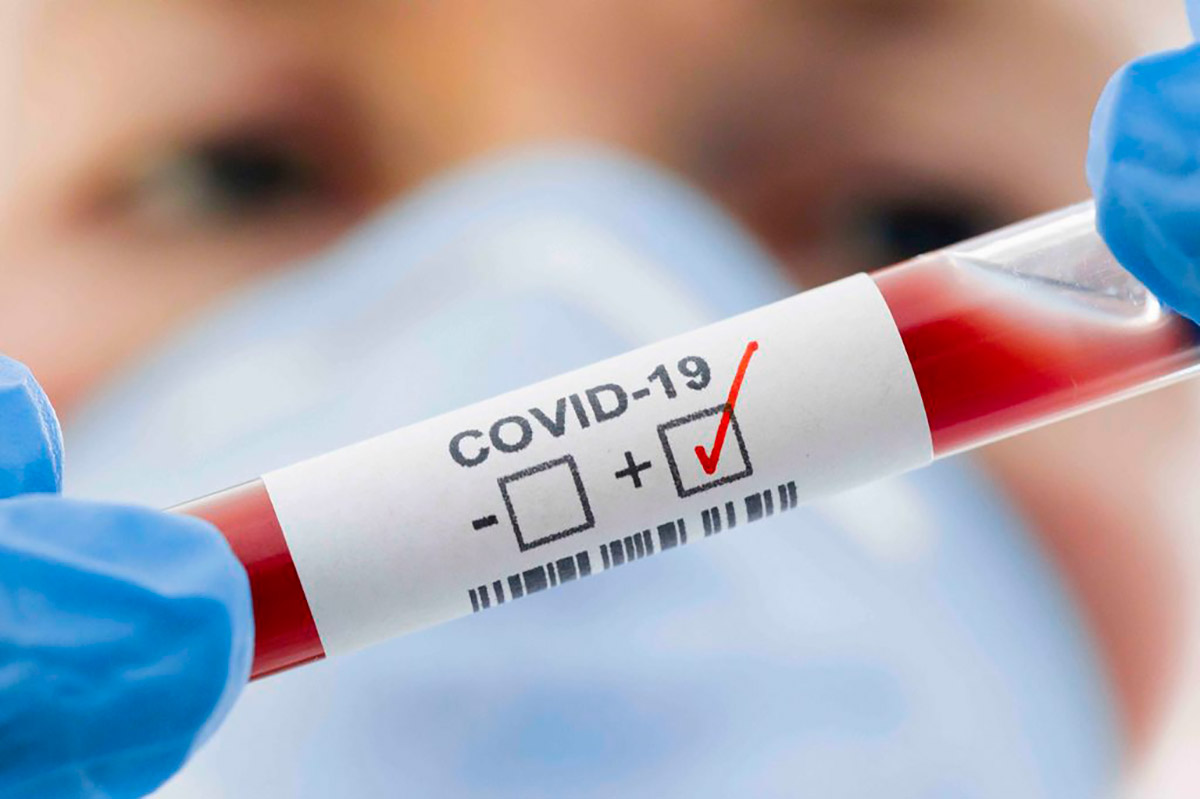 Coronavirus. In Abruzzo 184 nuovi contagi e 5 decessi. Nel Chietino 25.600 test